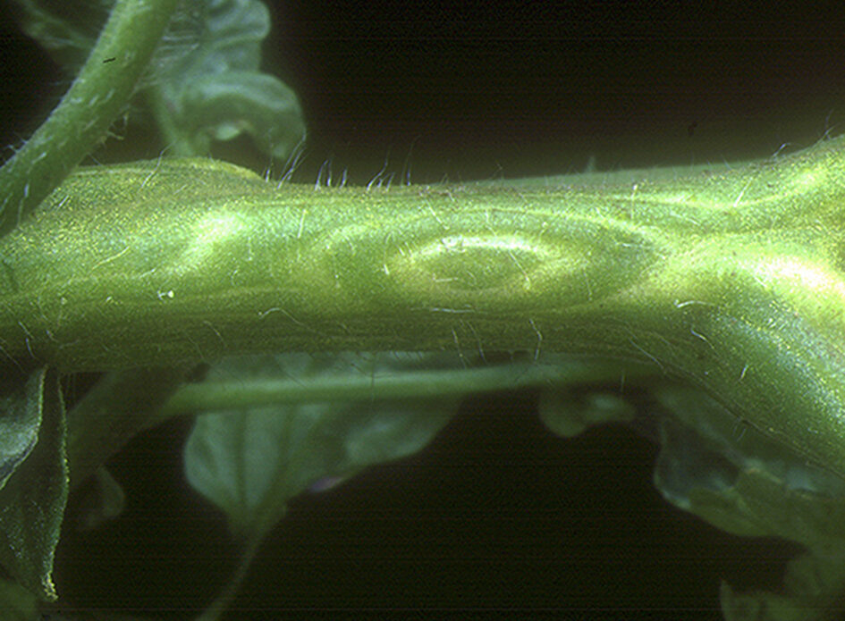 Enfermedad CAM234