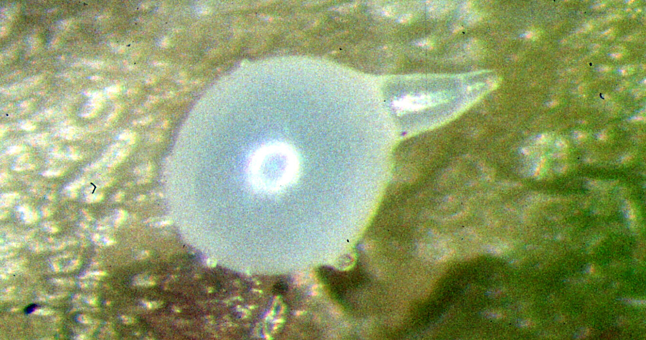 Enfermedad CAM210