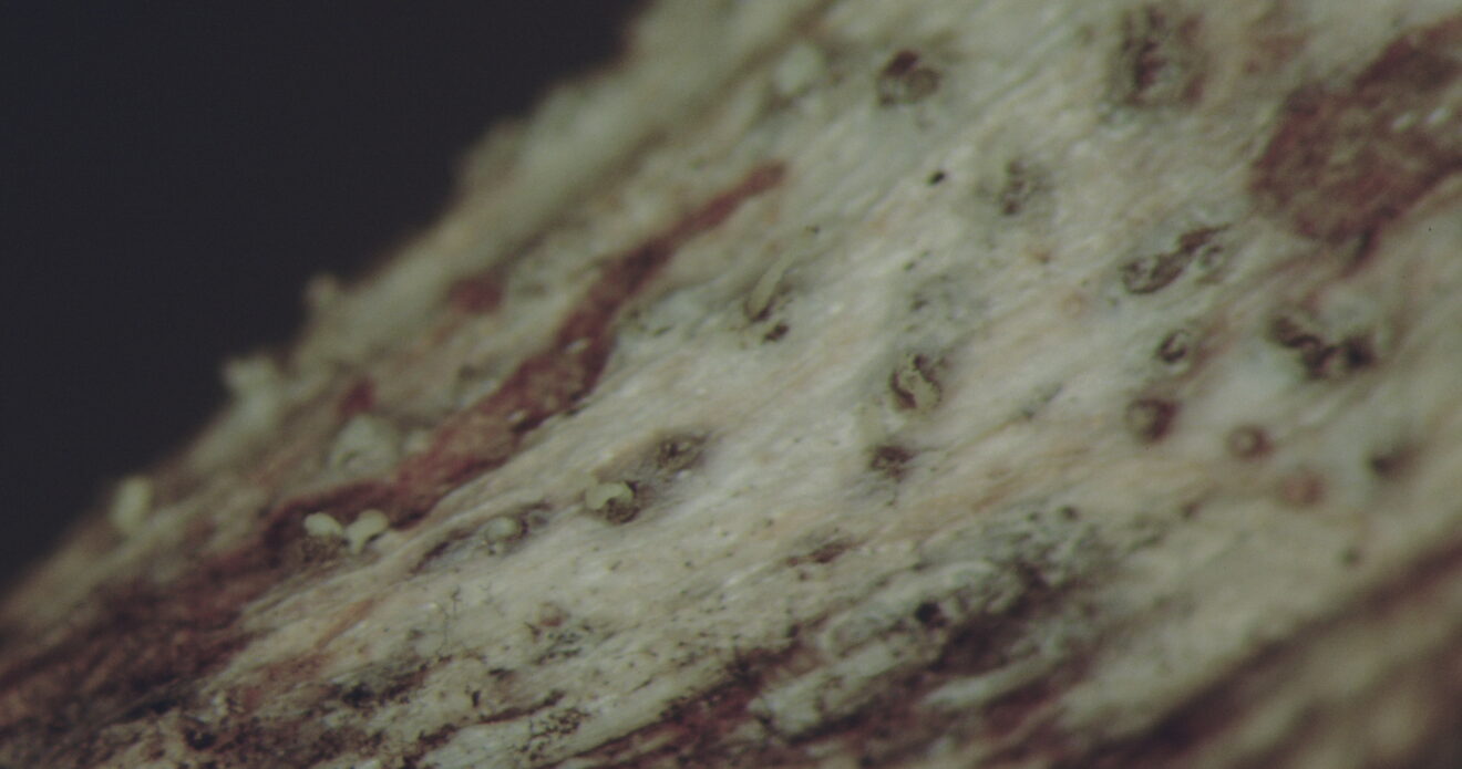 Enfermedad CAM373