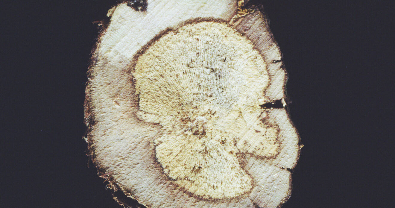 Enfermedad CAM375