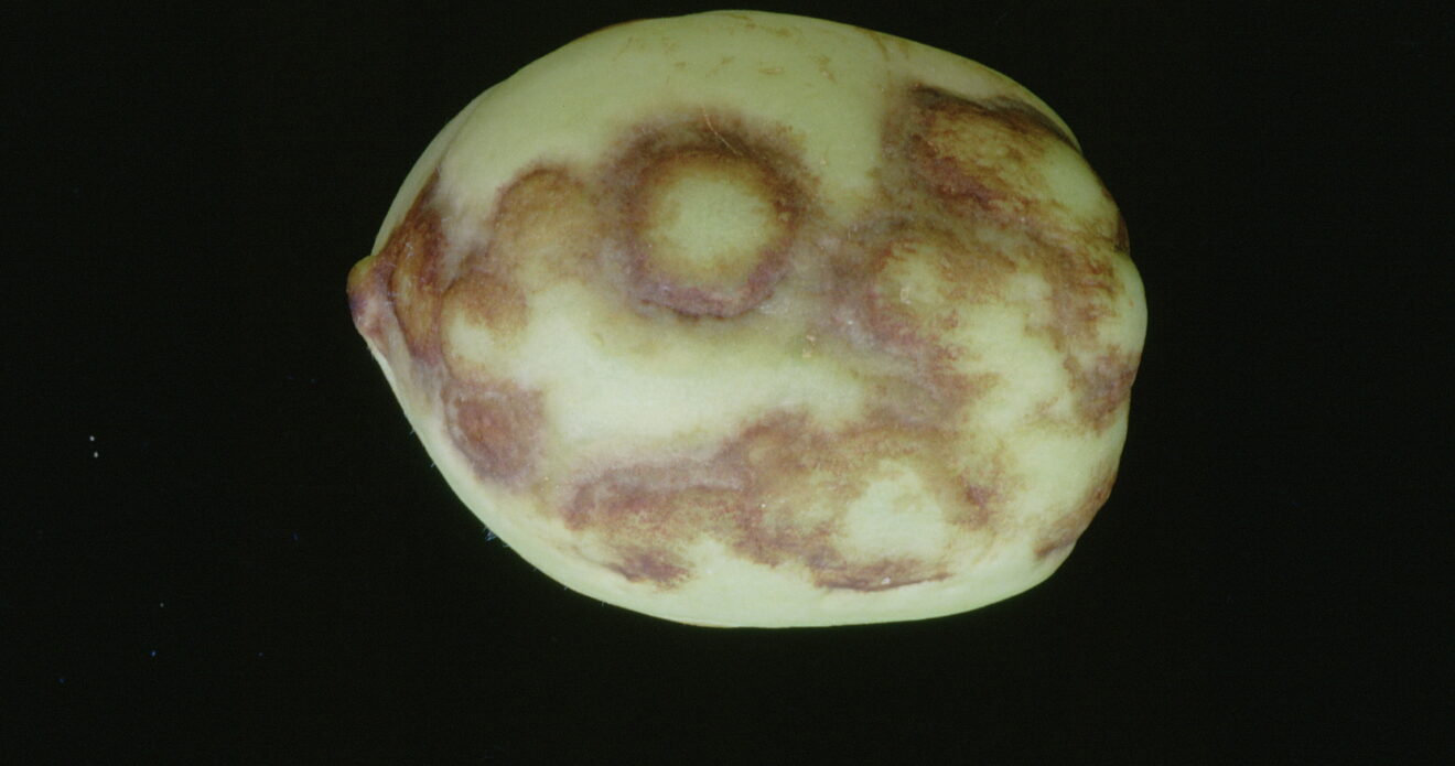 Enfermedad CAM579