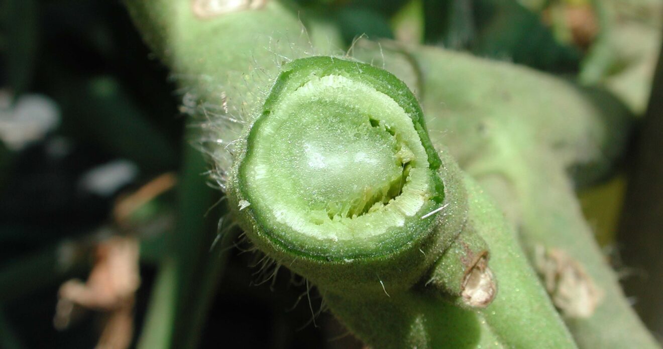 Enfermedad CAM6