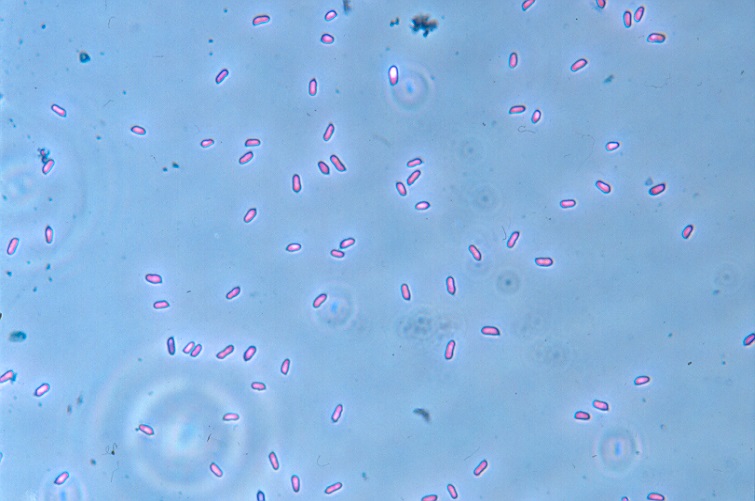 Enfermedad JPS138