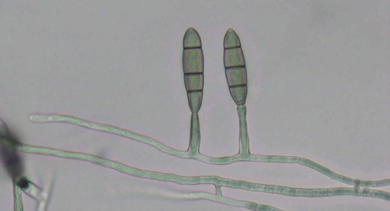 Enfermedad JPS22