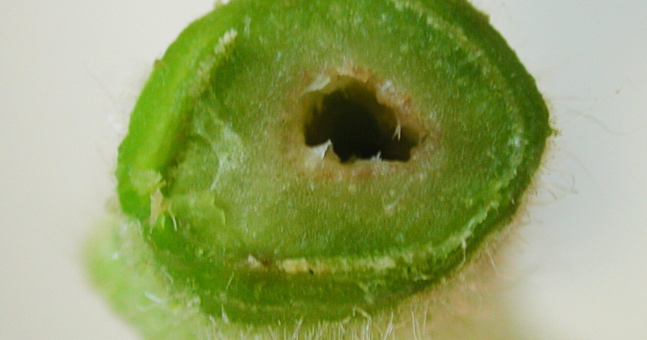 Enfermedad LAF28