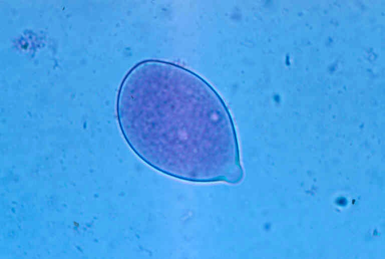 Enfermedad RSM119