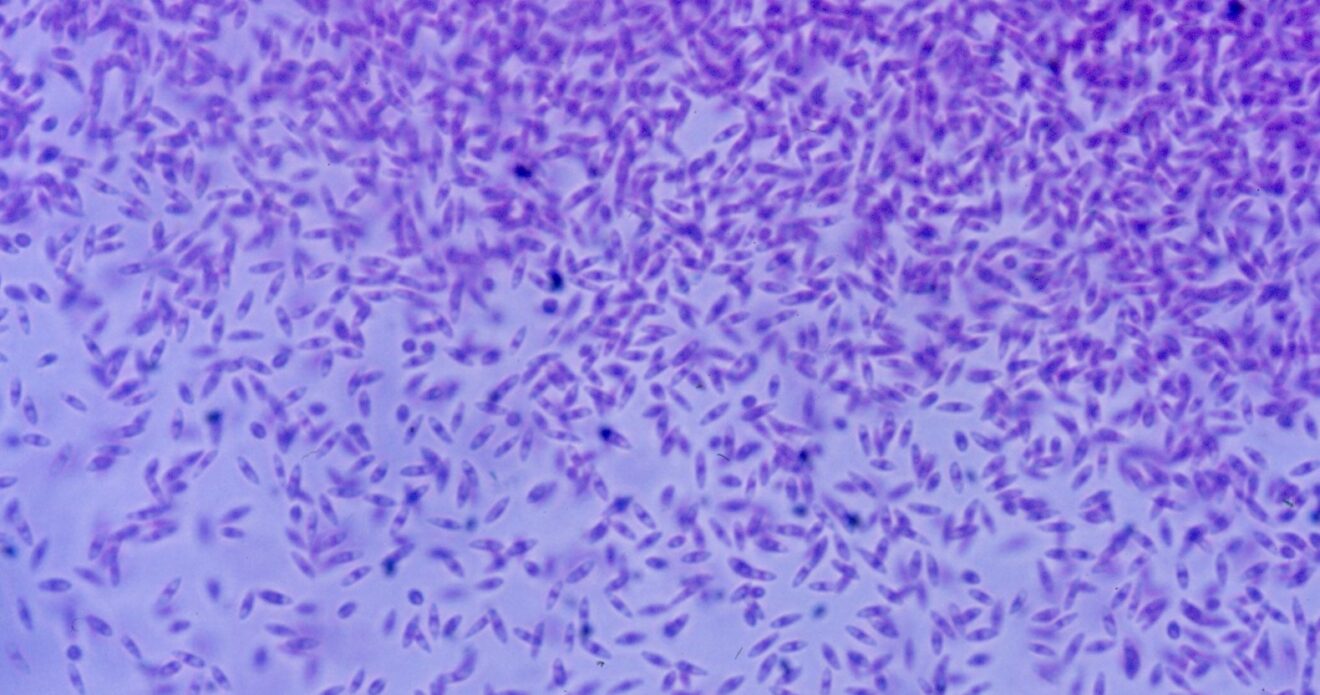 Enfermedad RSM182