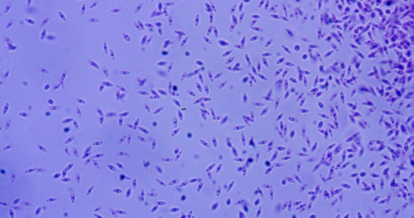 Enfermedad RSM183