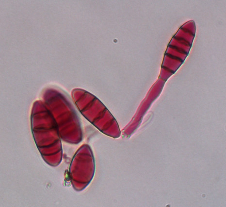 Enfermedad RSM196