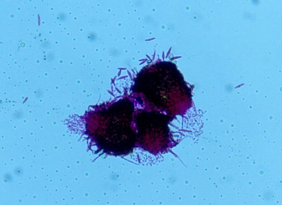 Enfermedad RSM213
