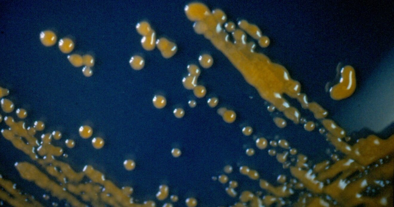 Enfermedad RSM22