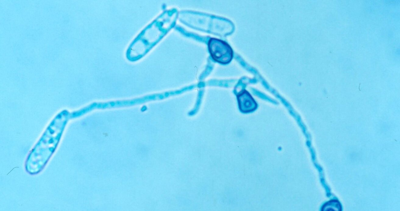 Enfermedad RSM222