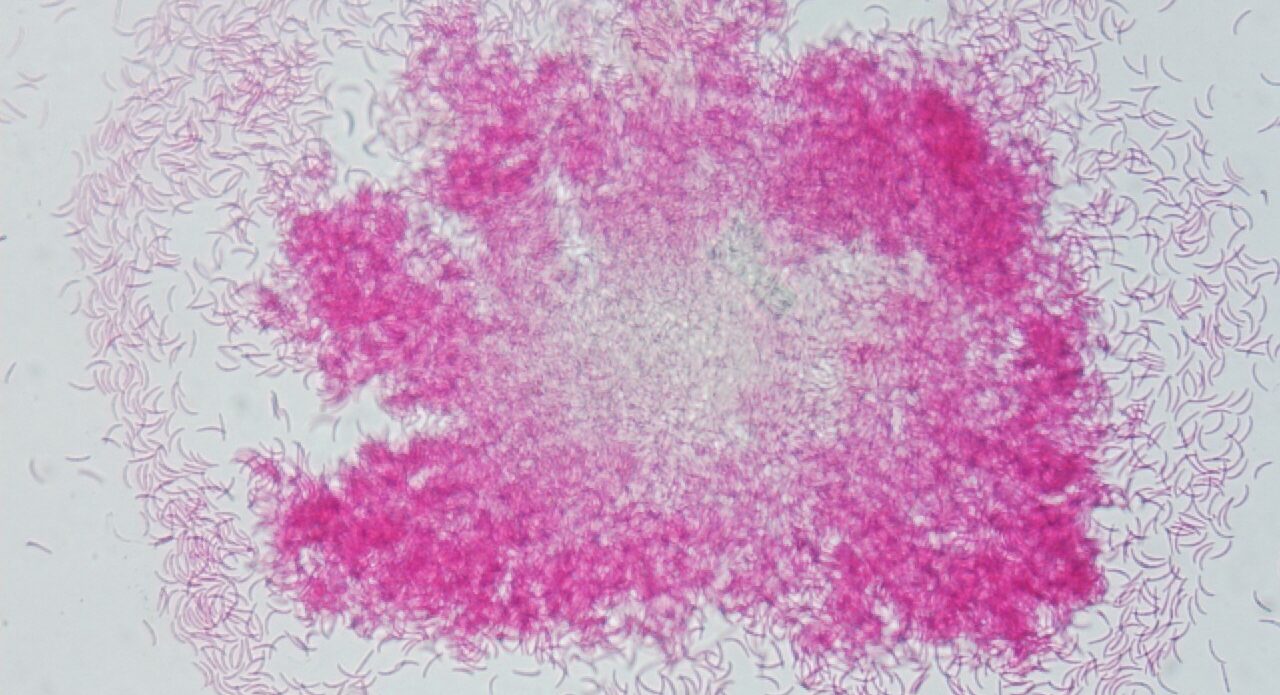 Enfermedad RSM227