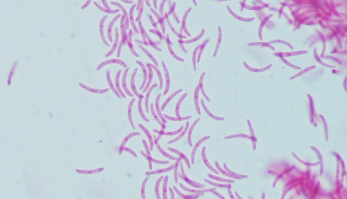 Enfermedad RSM228
