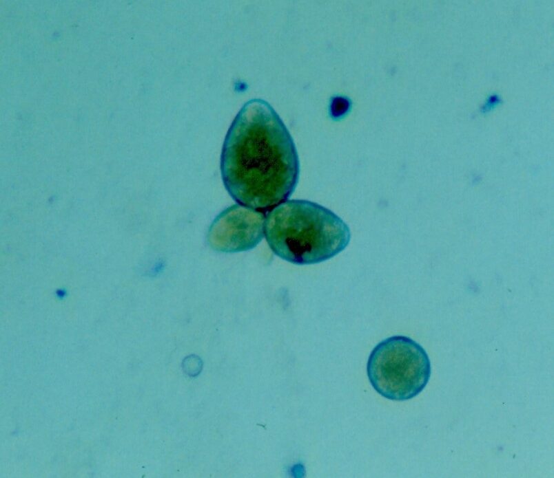Enfermedad RSM229