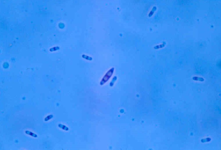 Enfermedad RSM312