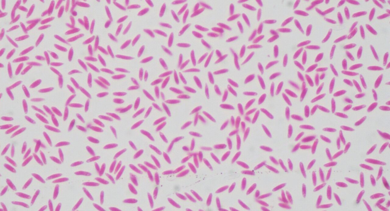 Enfermedad RSM316