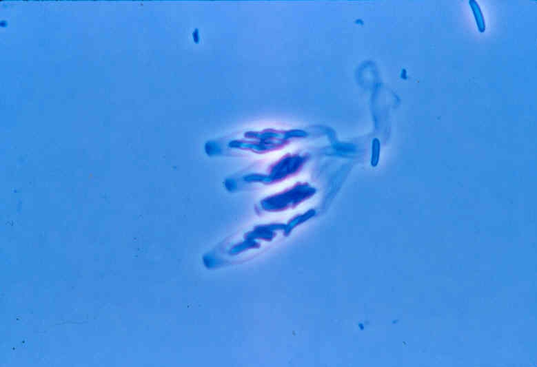 Enfermedad RSM324