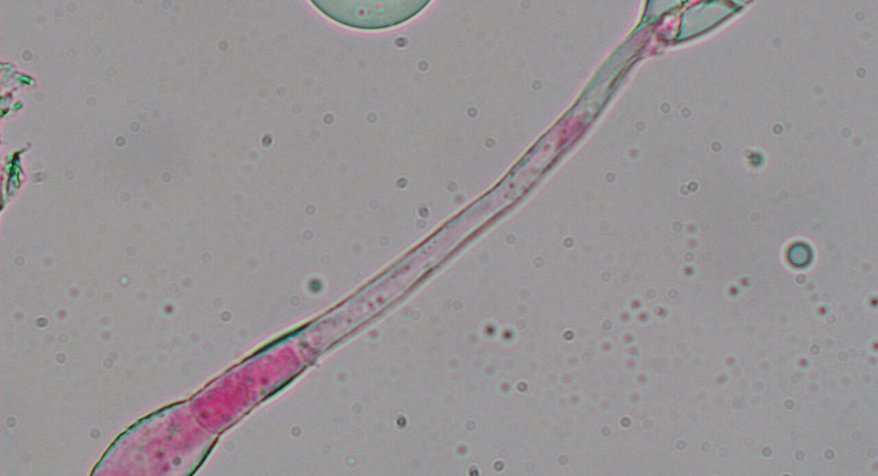 Enfermedad RSM369