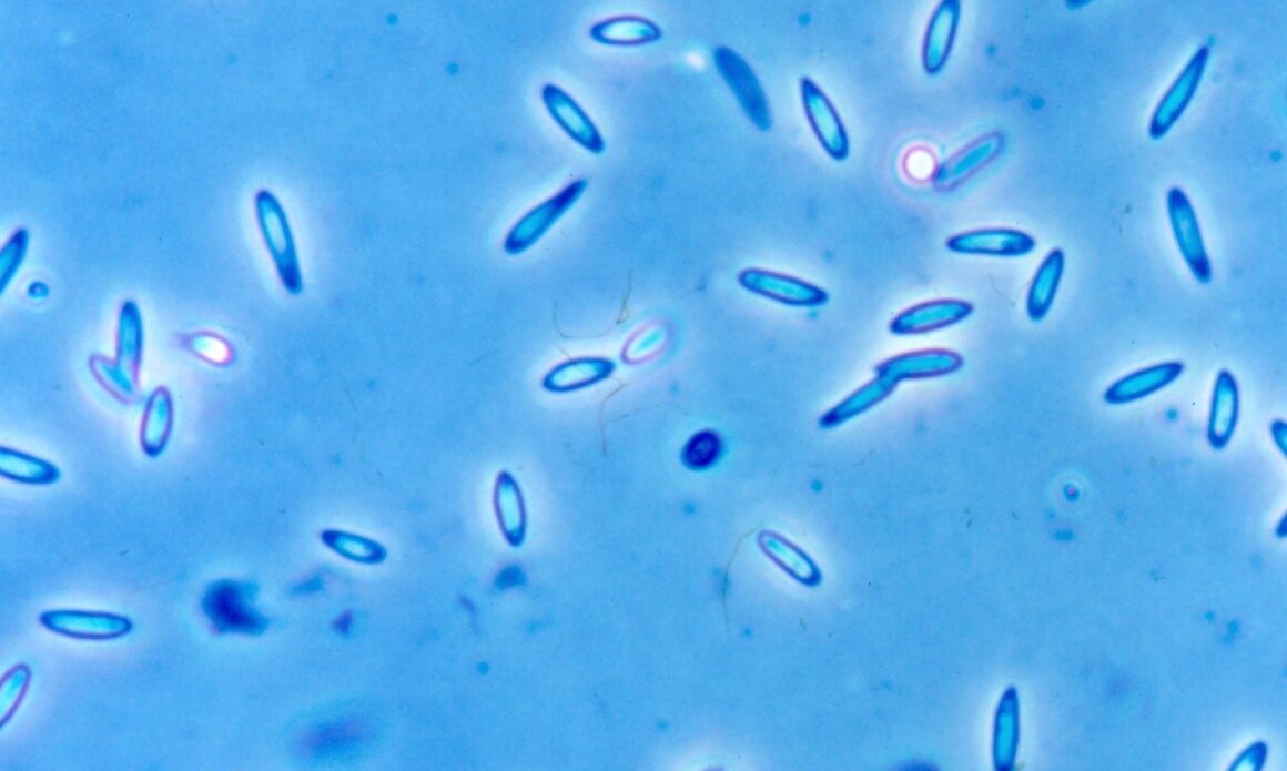 Enfermedad RSM398