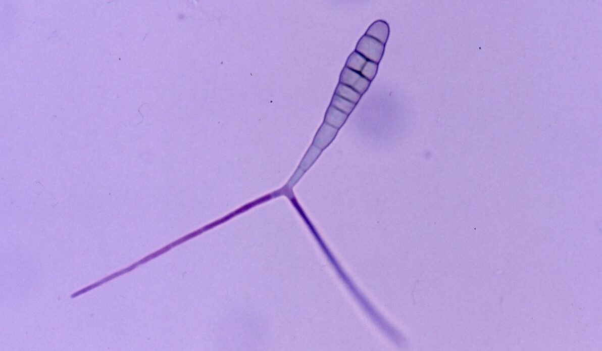 Enfermedad RSM43