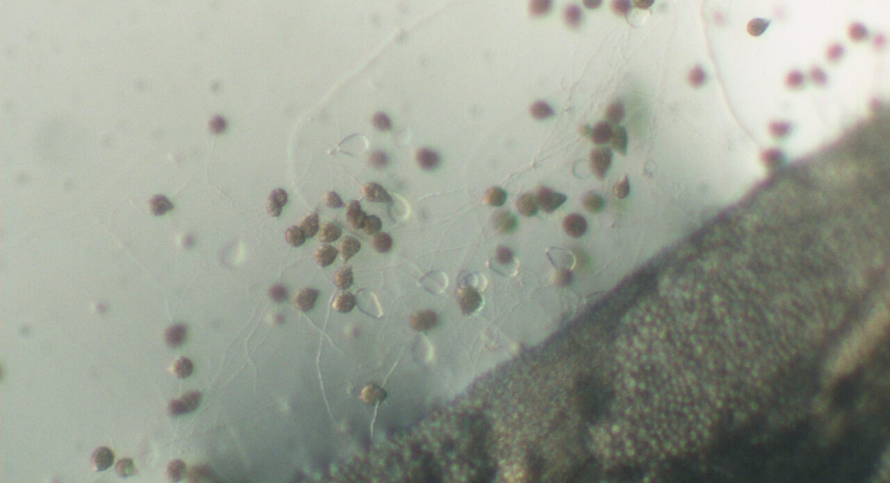 Enfermedad RSM489