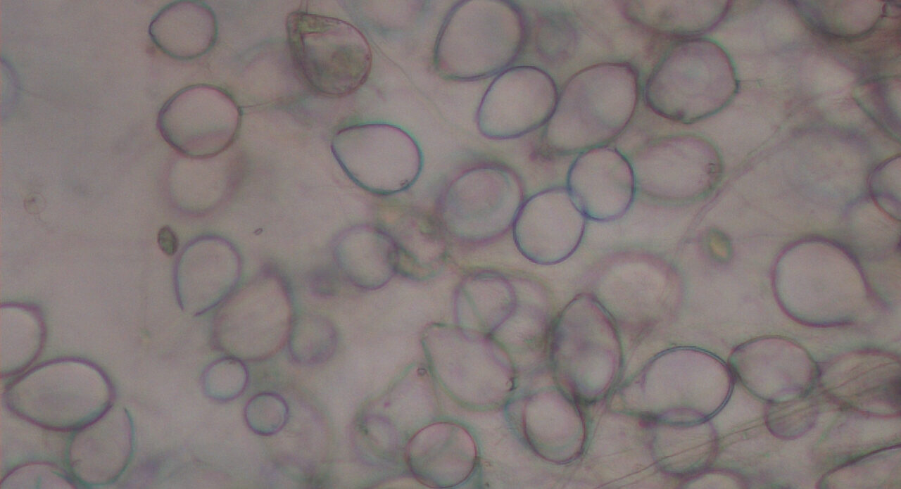 Enfermedad RSM492