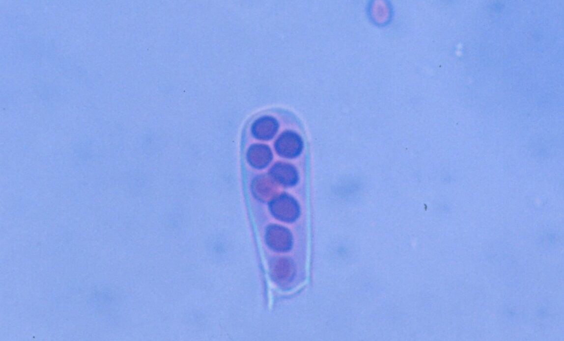Enfermedad RSM517