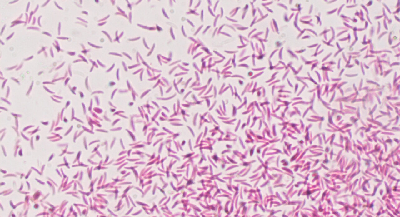 Enfermedad RSM543