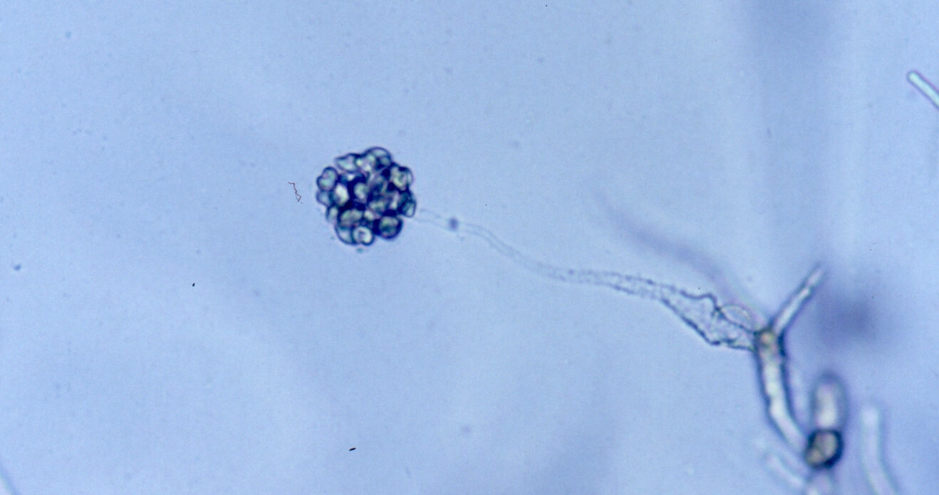 Enfermedad RSM165
