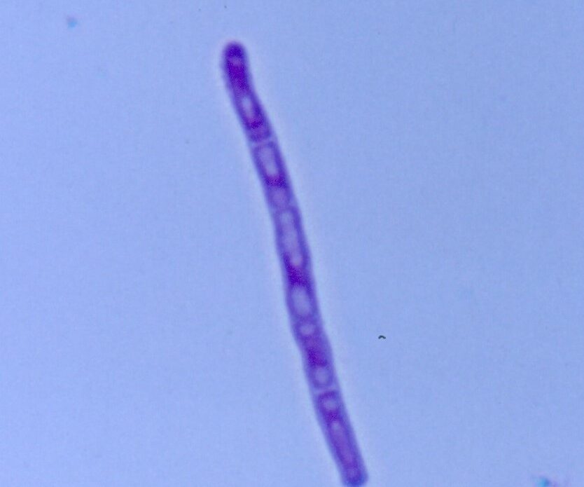Enfermedad RSM231