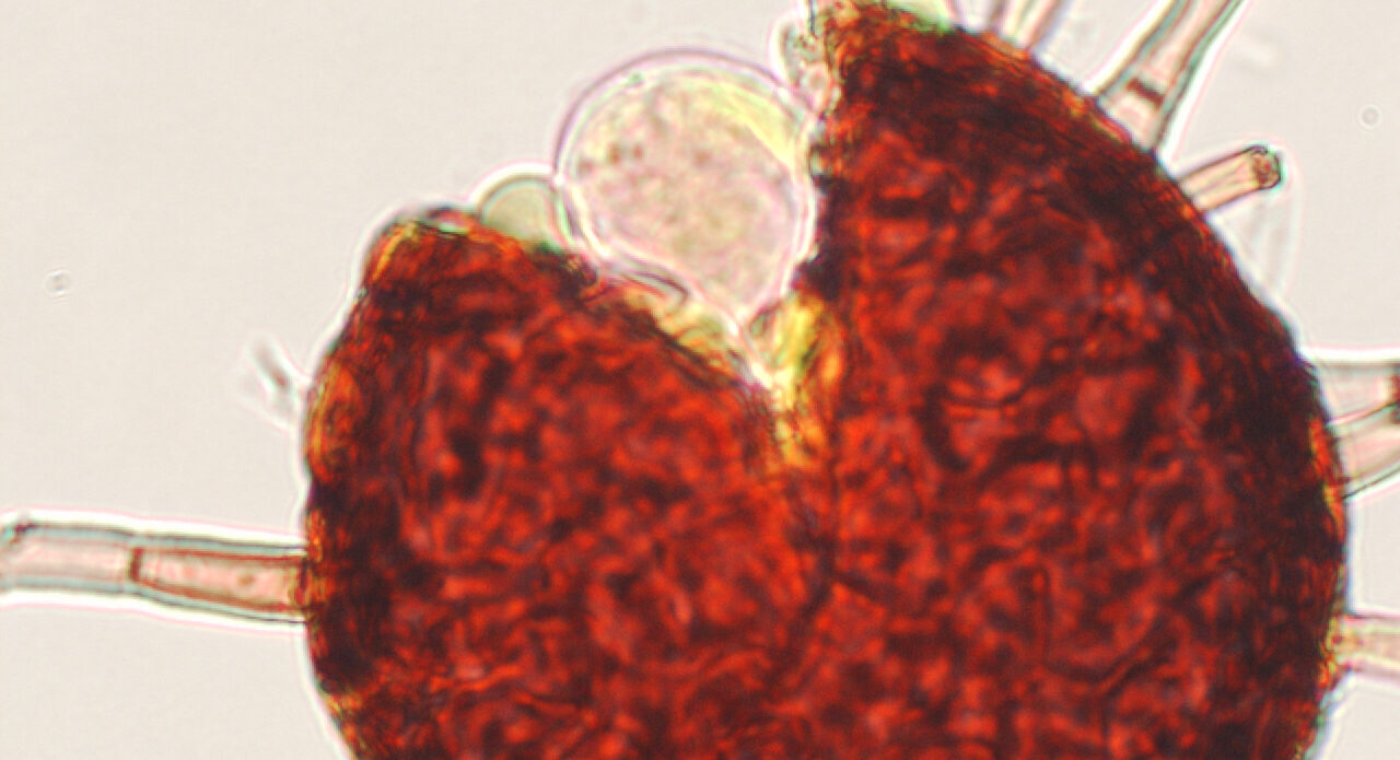 Enfermedad RSM374