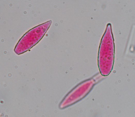Enfermedad RSM59