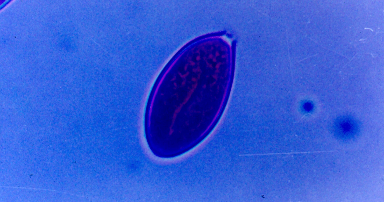 Enfermedad RSM95